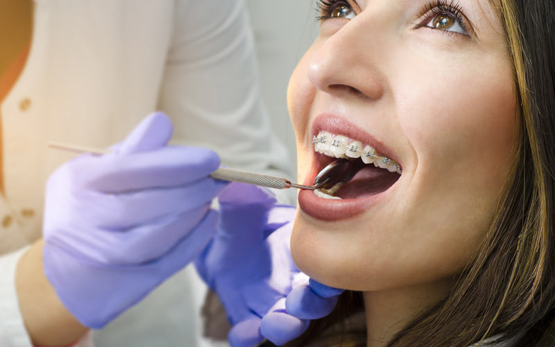 در هر بار معاینه دندانپزشک سیم فلزی را سفت می‌کند تا دندان‌ها جابه‌جا شوند.