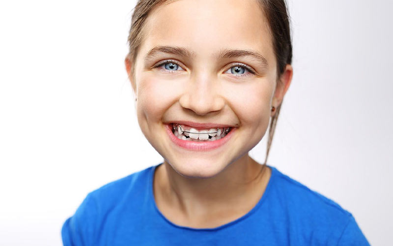 از مزایای ارتودنسی دو مرحله ای می‌توان به بهبود لبخند و افزایش اعتمادبه‌نفس اشاره کرد.