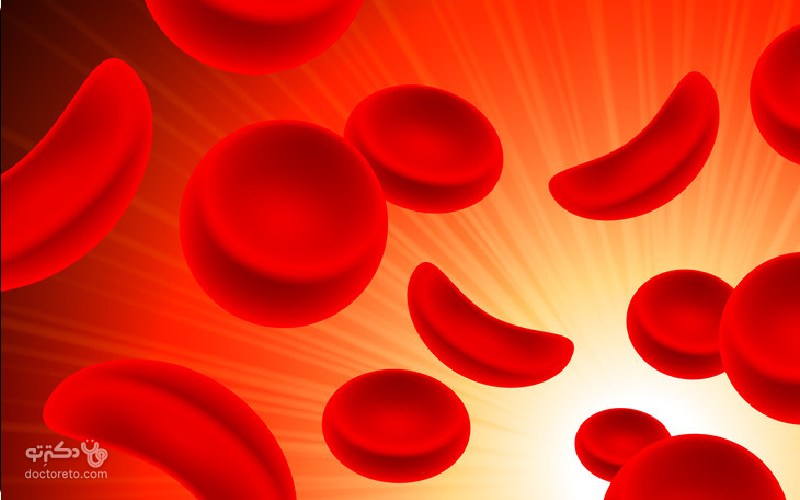 کم خونی داسی شکل چیست؟