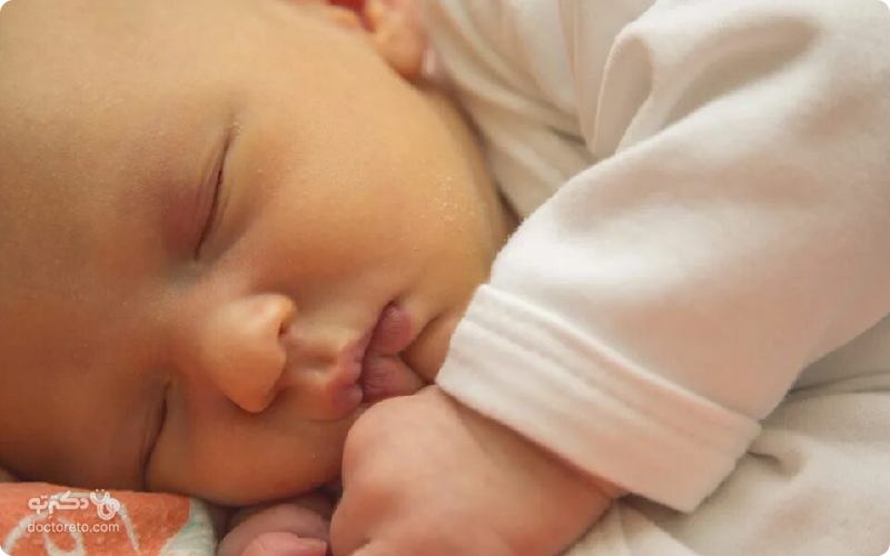 حجامت نوزاد برای درمان زردی موثر است؟