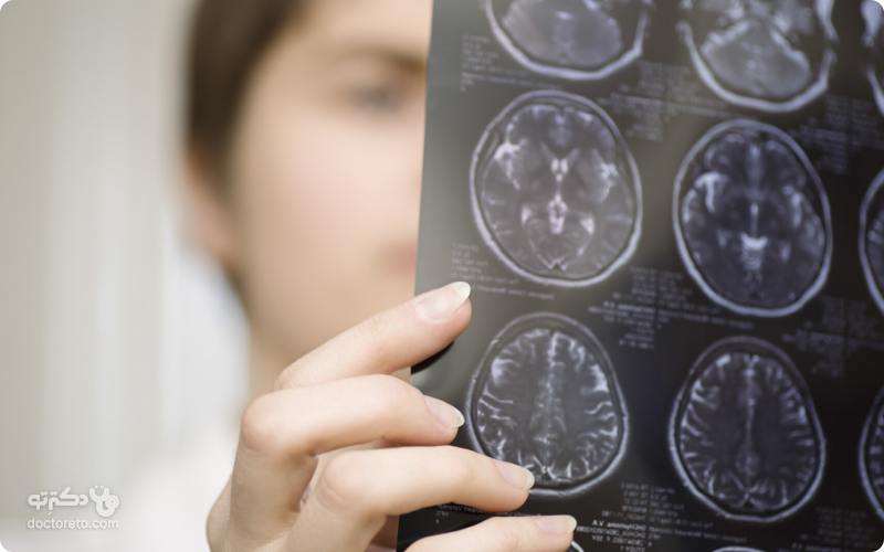روش تشخیص سرطان مغز، از کجا بفهمیم تومور مغزی داریم؟