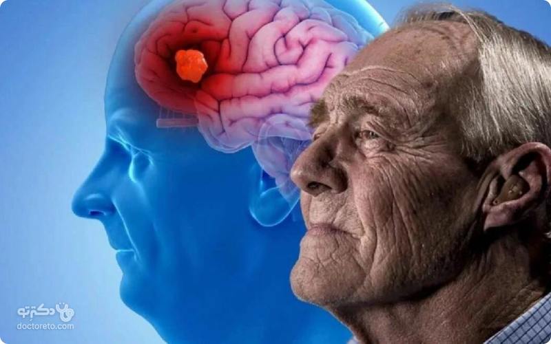 علائم تومور مغزی در سالمندان چیست؟