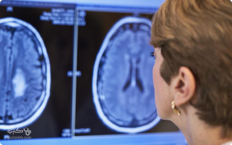 جدیدترین درمان تومور مغزی چطور کار می کند؟