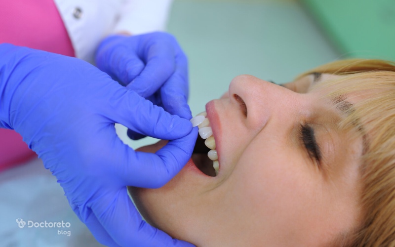 دلایل افتادن لمینت دندان چیست و روش جلوگیری از آن چگونه است؟