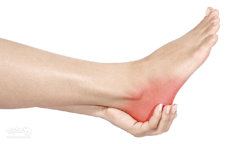 روش درمان درد پاشنه پا چیست؟