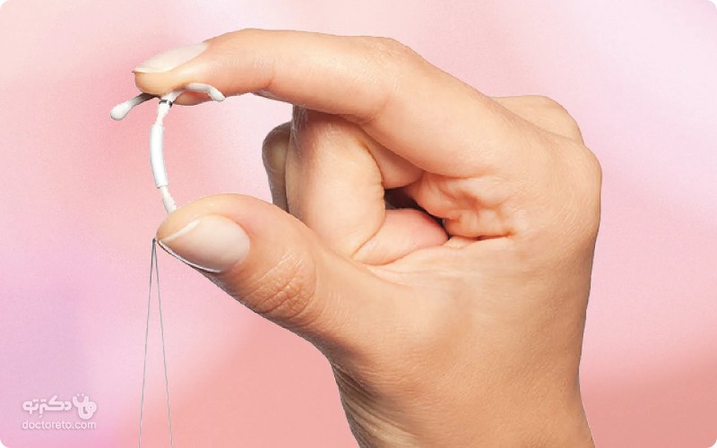 طول عمر IUD هورمونی چقدر است؟