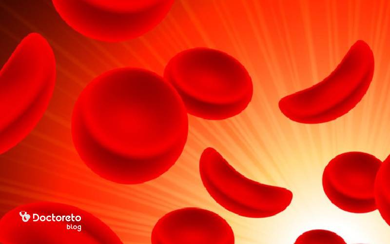 کم خونی داسی شکل یا بیماری آنمی سیکل سل چیست؟