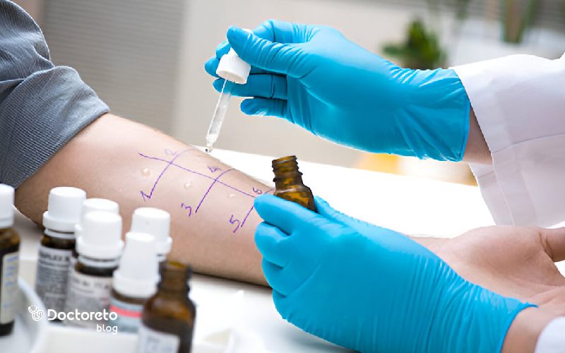 آزمایش حساسیت پوستی