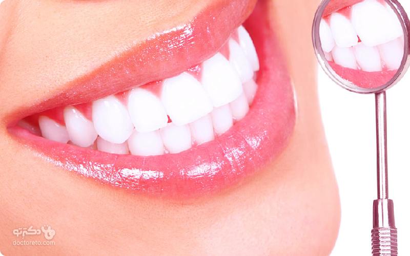 بهترین روش های سفید کردن دندان فوری چیست؟ 