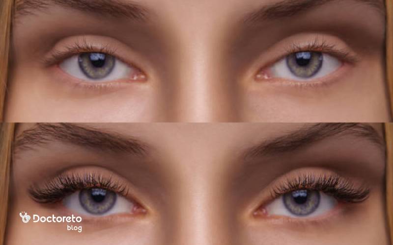 عکس کاشت مژه موقت