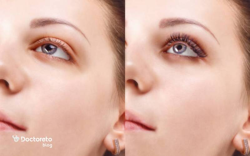 مژه والیوم نچرال