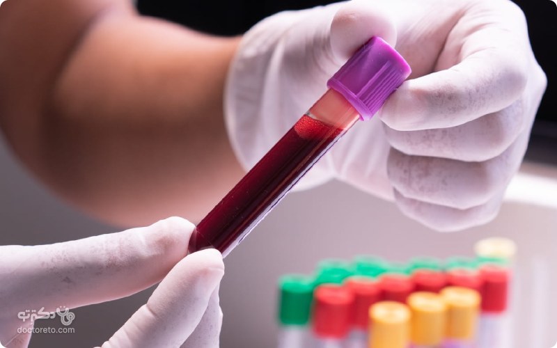 چه زمانی باید آزمایش MCH خون داد؟