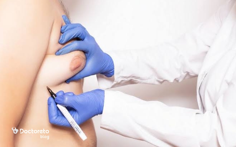 بیوپسی برای تشخیص ژنیکوماستی