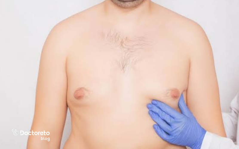 تصویربرداری برای تشخیص ژنیکوماستی