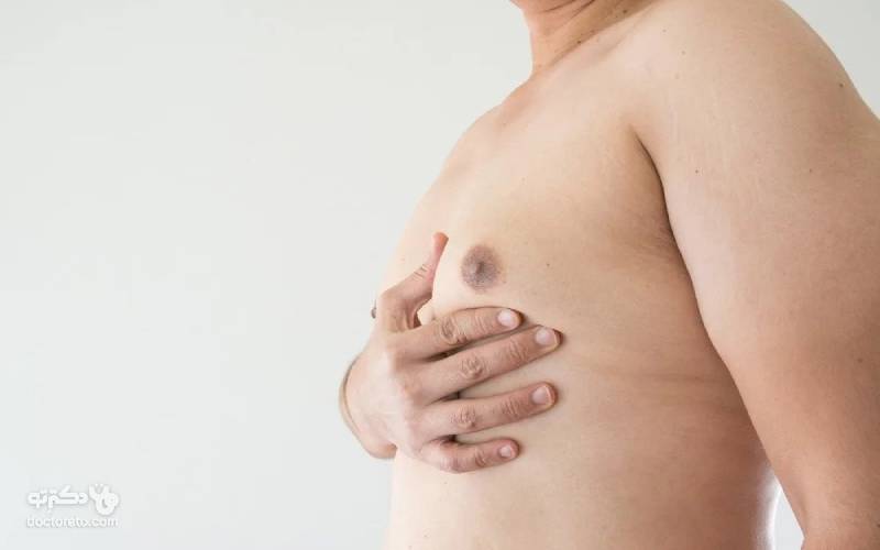 تغییر حالت و بزرگ شدن پستان در مردان ممکن است خودبه‌خود رفع شود و نیازی به راه های درمان بیماری ژنیکوماستی نباشد. 