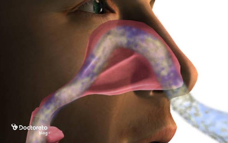 مزایای عمل پولیپ بینی