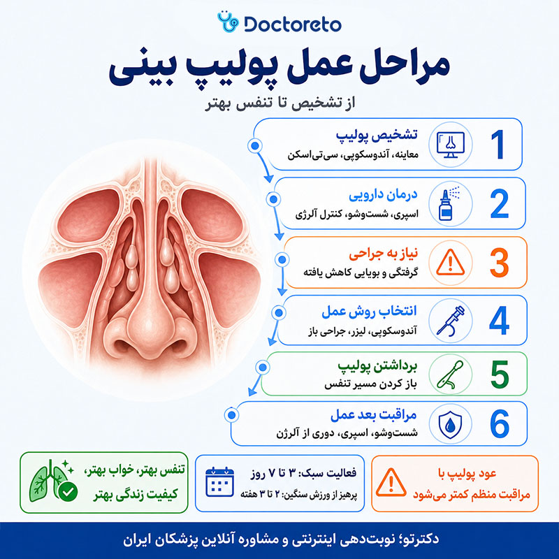 اینفوگرافی عمل پولیپ بینی