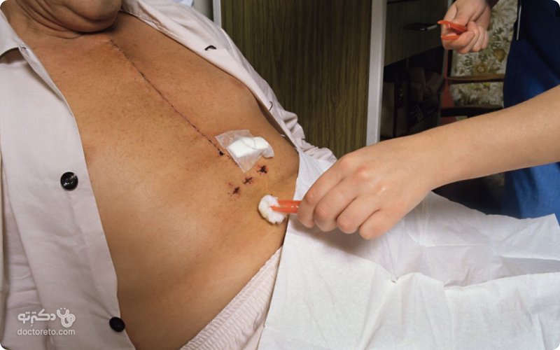 عمل قلب باز در بیماران دیالیزی ضرر دارد؟