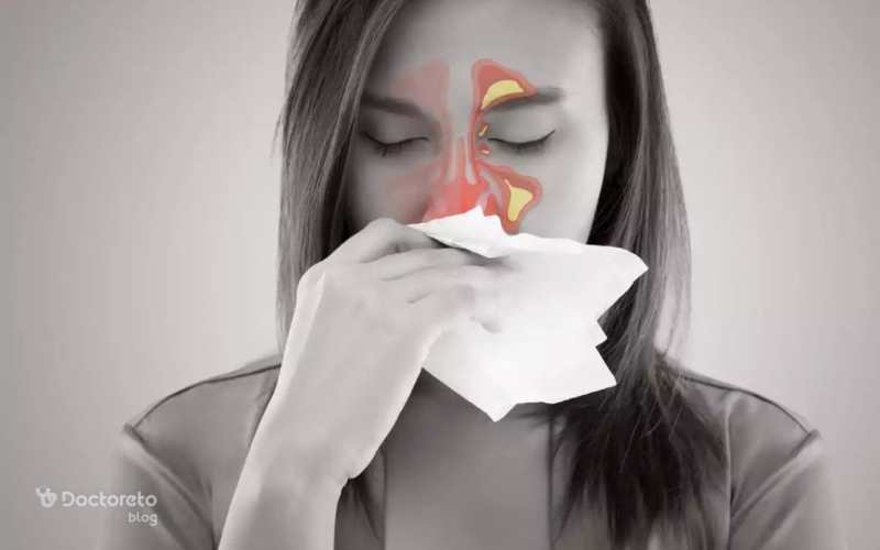 التهاب پوشش داخلی حفره‌های بینی باعث ایجاد گرفتگی، احتقان و سخت شدن تنفس می‌شود. 