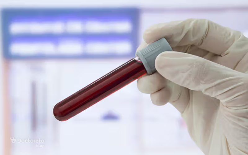 آزمایش هموگلوبین برای چیست و چه زمانی باید آزمایش هموگلوبین خون انجام دهم؟