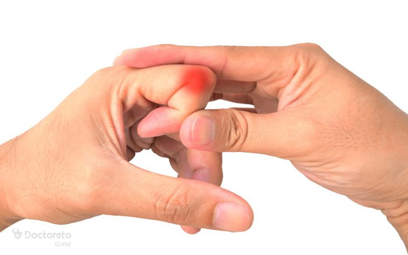 آیا شکستن قولنج انگشتان ضرر دارد؟