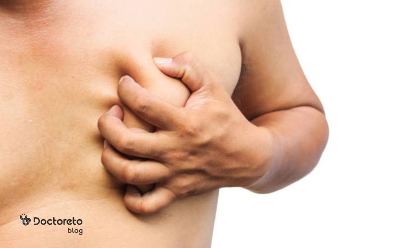 تورم و سنگینی در ژنیکوماستی