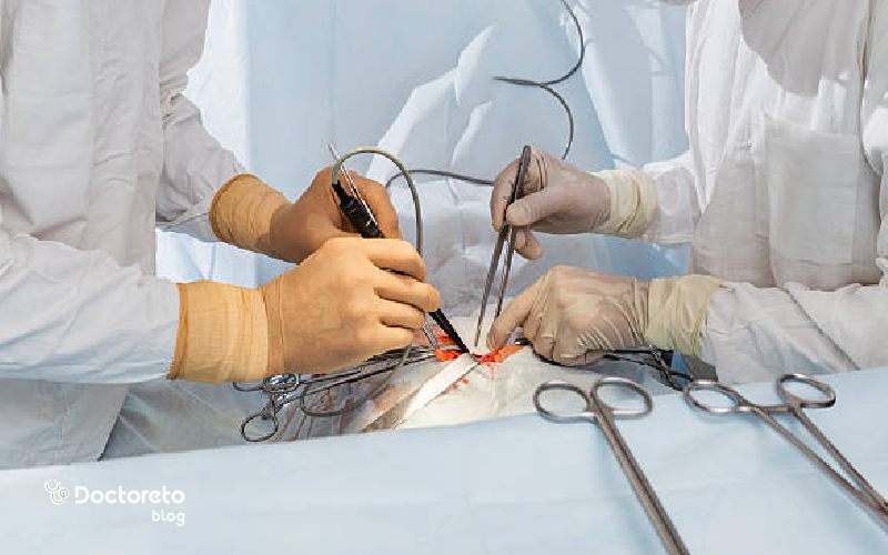عکس پبوند قلب