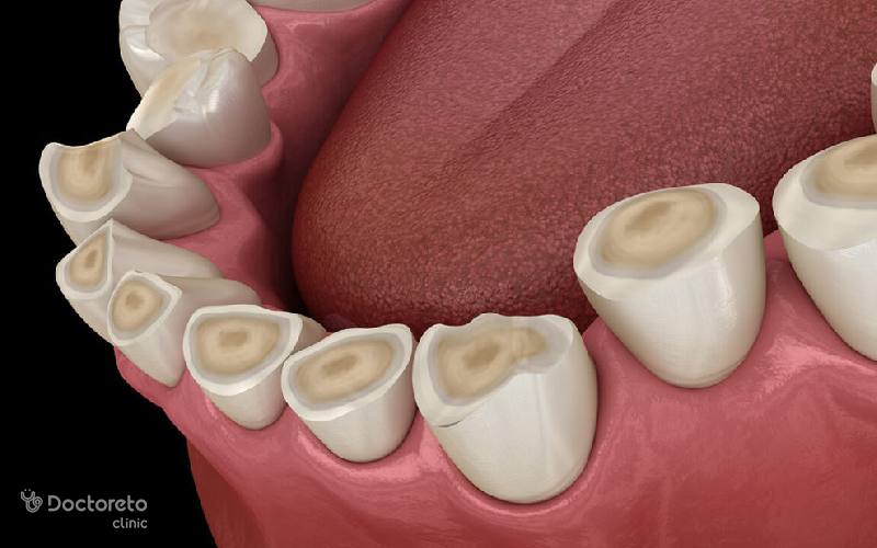 عوارض دندان قروچه چیست؟
