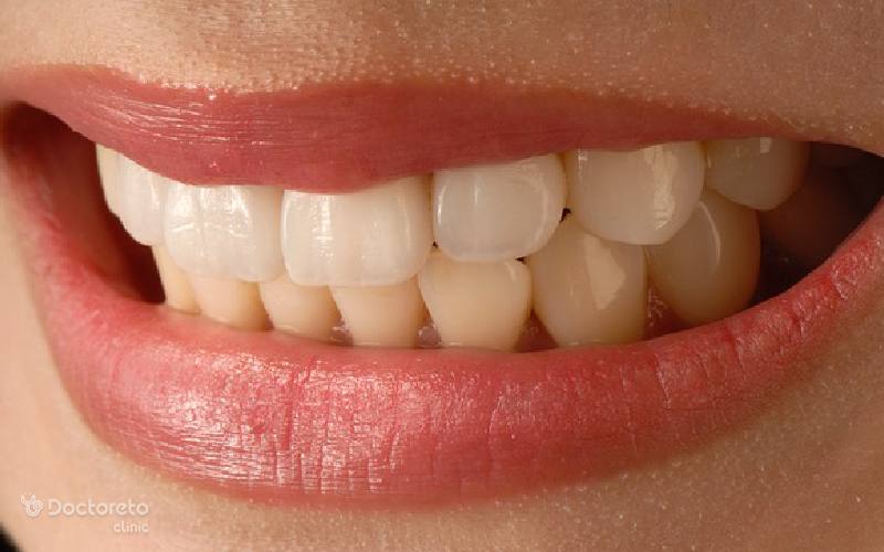 علائم همراه با دندان قروچه چیست؟