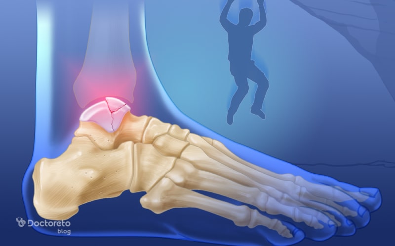 عوارض شکستگی کف پا درد حین راه رفتن است.