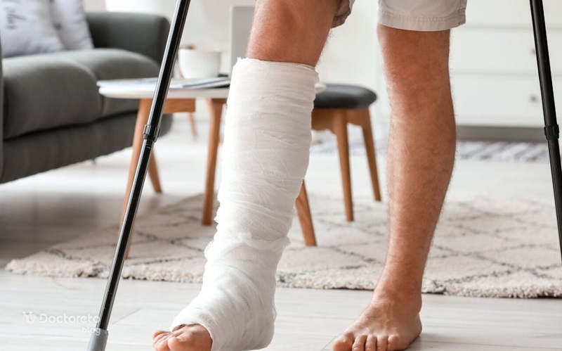 زمان درمان شکستگی پا به عوامل مختلفی بستگی دارد.