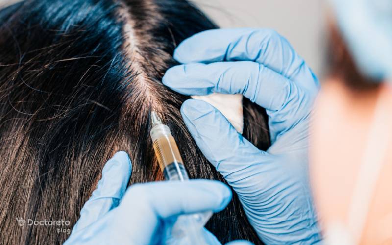 آیا می توان عوارض مزوتراپی موی سر را کاهش داد؟