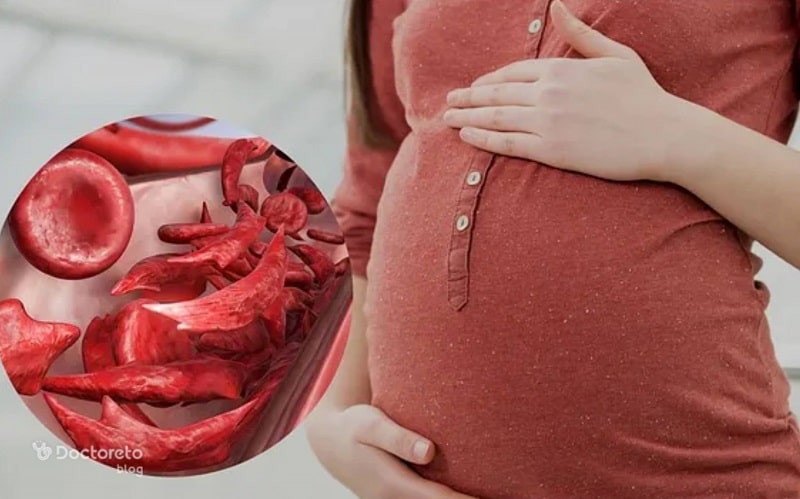 انواع کم خونی در بارداری ممکن است ایجاد شود.