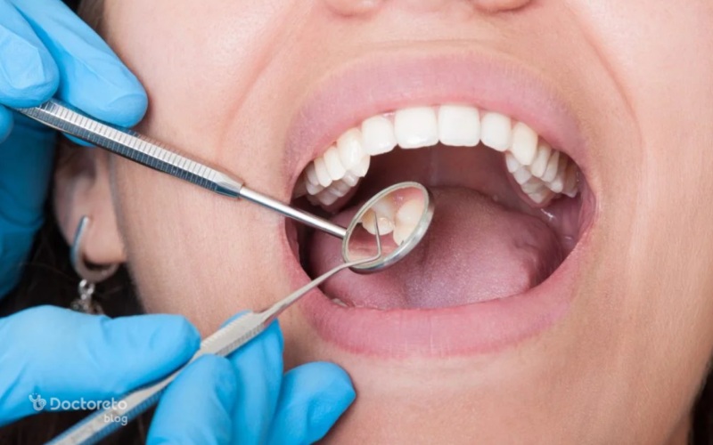 علائم عفونت ایمپلنت دندان چیست؟