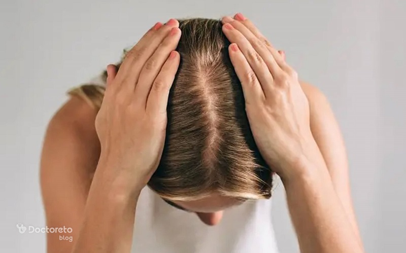 هایفو مو برای تقویت ریشه مو انجام میشود.