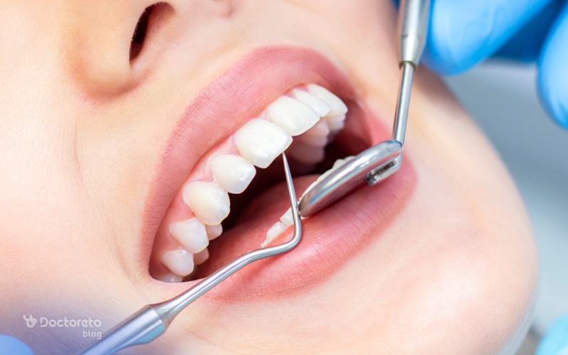 چگونه بهترین نوع روکش دندانی را انتخاب کنیم؟
