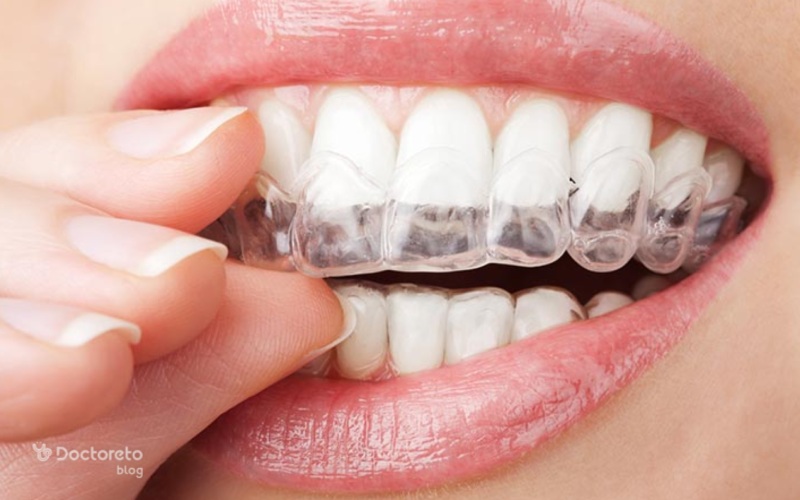 روش کاهش تاثیر سیگار روی لمینت دندان چیست؟