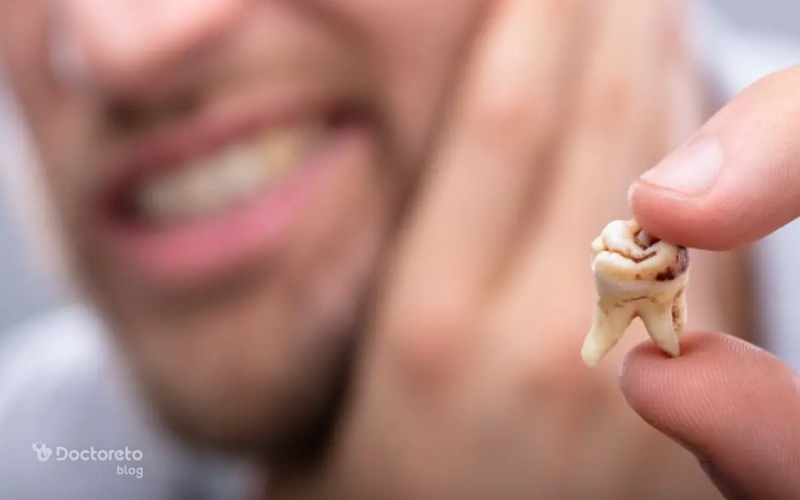 آیا کامپوزیت و لمینت باعث پوسیدگی دندان می شود؟