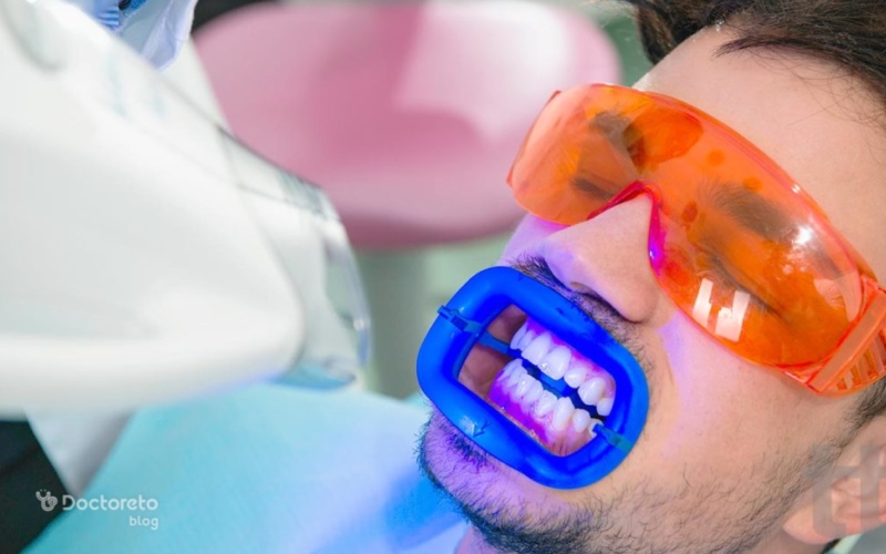 بلیچینگ دندان با لیزر چگونه انجام می شود؟
