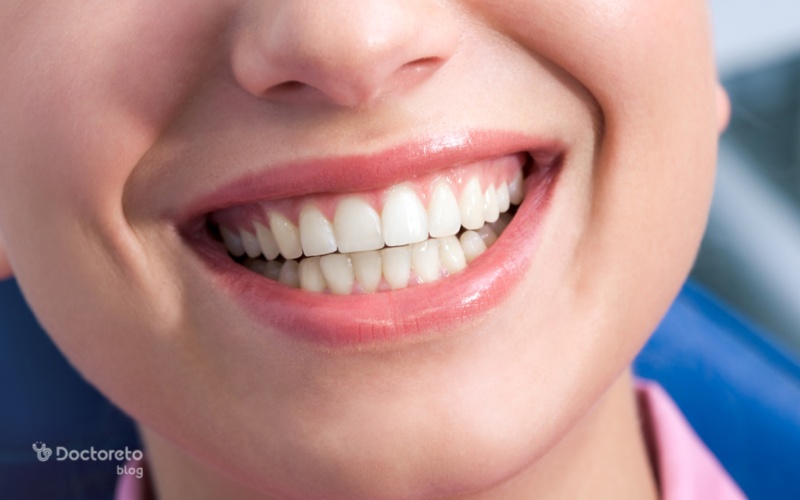 طول عمر مورد انتظار لمینت دندان چقدر است؟