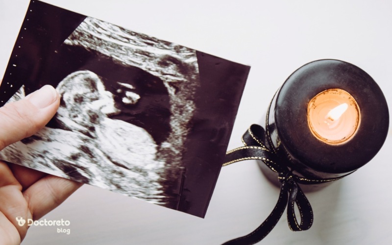 علت سقط مکرر در ماه اول بارداری