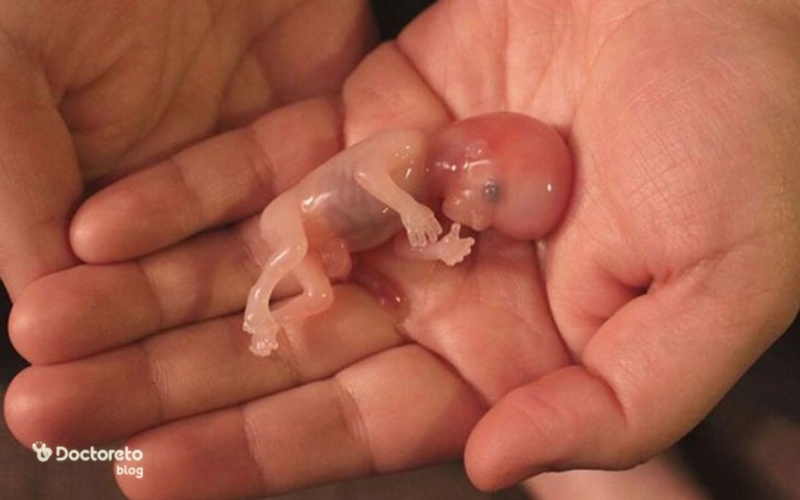 سقط مکرر بدون دلیل