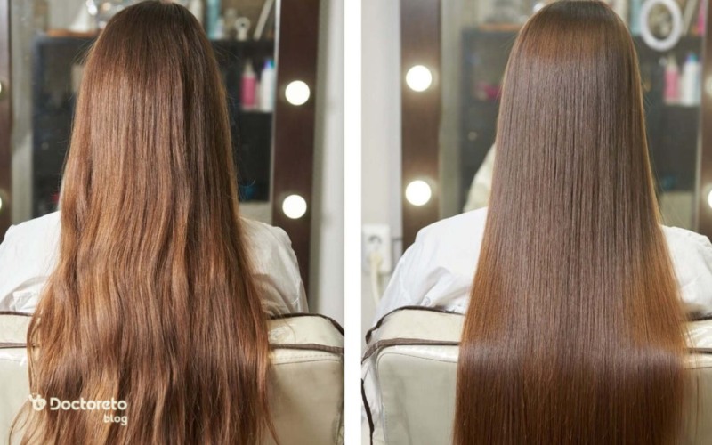 عکس قبل و بعد بوتاکس مو