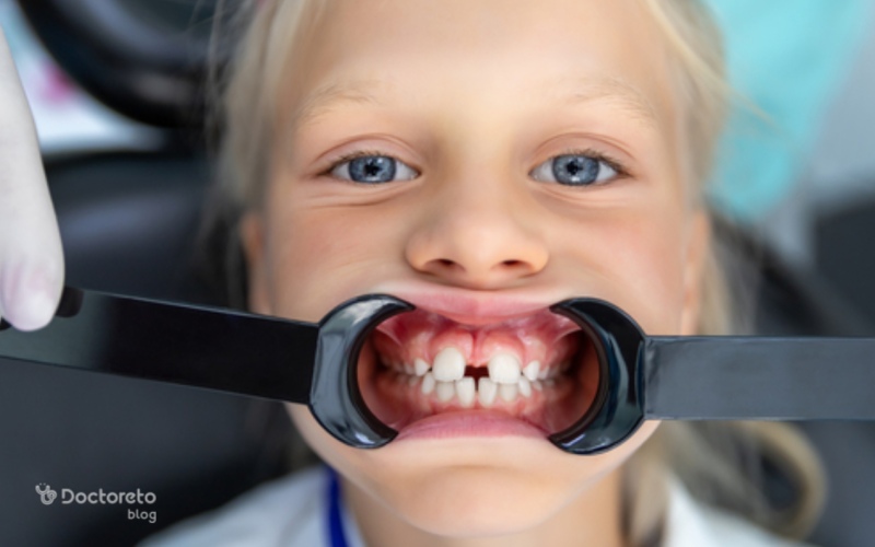 آیا ارتودنسی کودکان شکاف بین دندان های جلویی را برطرف می کند؟