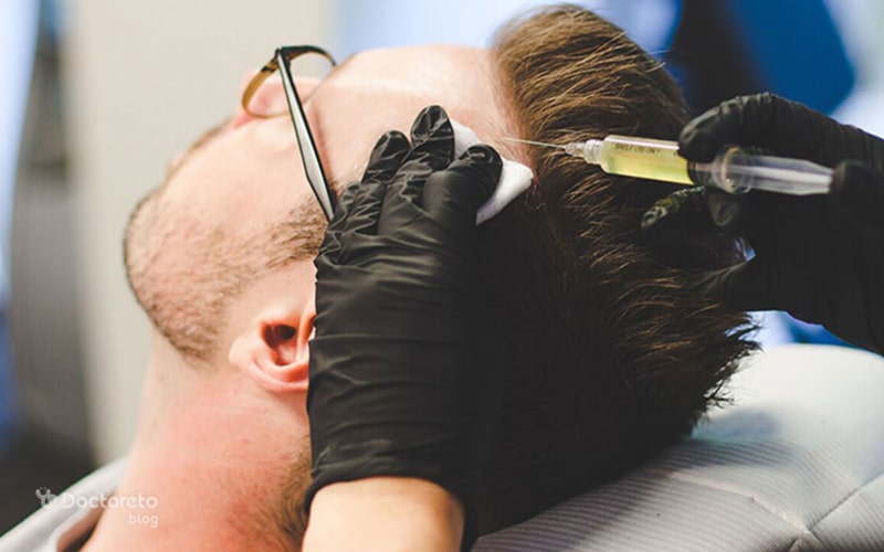 مزوتراپی با پی ار پی هر دو در درمان ریزش مو موثر هستند.