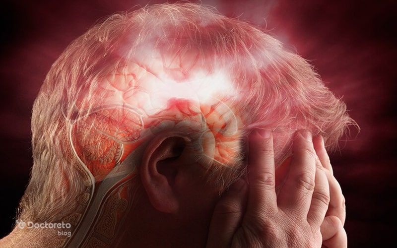 آمبولی مغزی چیست؟ علائم، علل و راه درمان آن