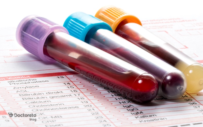 آزمایش خون برای تشخیص بیماری قلبی موثر است؟