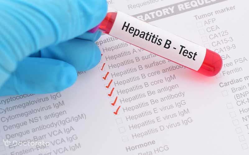 هپاتیت را می توان با آزمایش خون تشخیص داد.