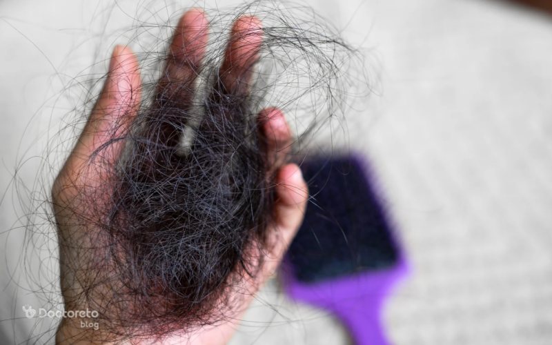 ریزش مو در شیردهی به دلیل تغییرات هورمونی ایجاد می شود.