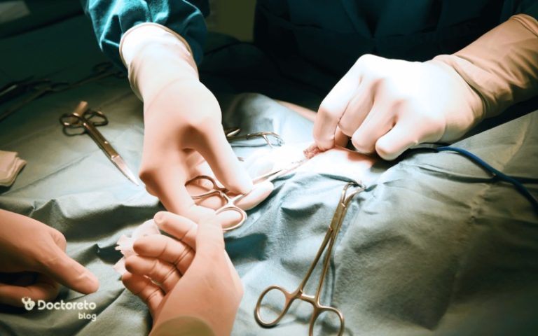 عمل مونس پلاستی: مزایا، عوارض و روش انجام آن